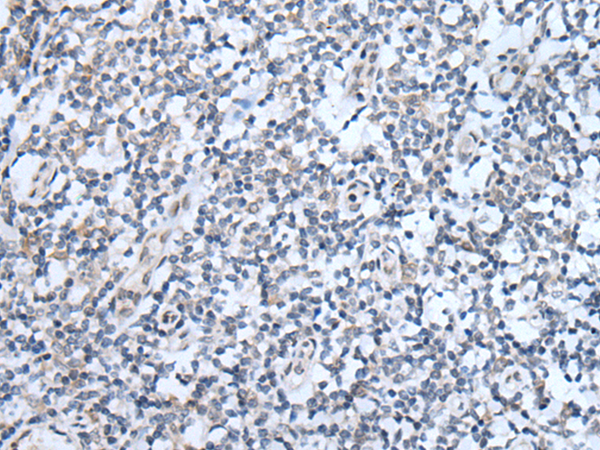 Rabbit Polyclonal Antibody to ABCA6