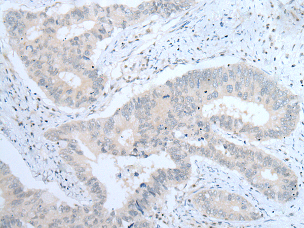Rabbit Polyclonal Antibody to ITGA8