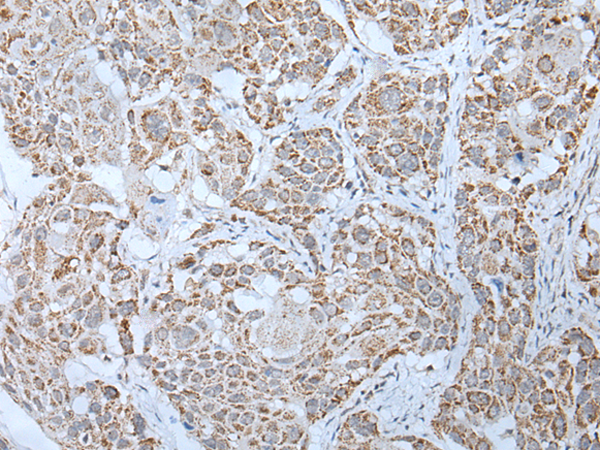 Rabbit Polyclonal Antibody to LHCGR