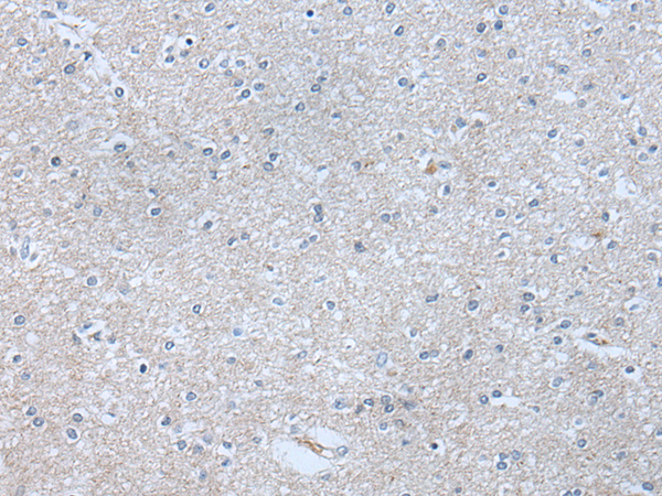 Rabbit Polyclonal Antibody to ABR