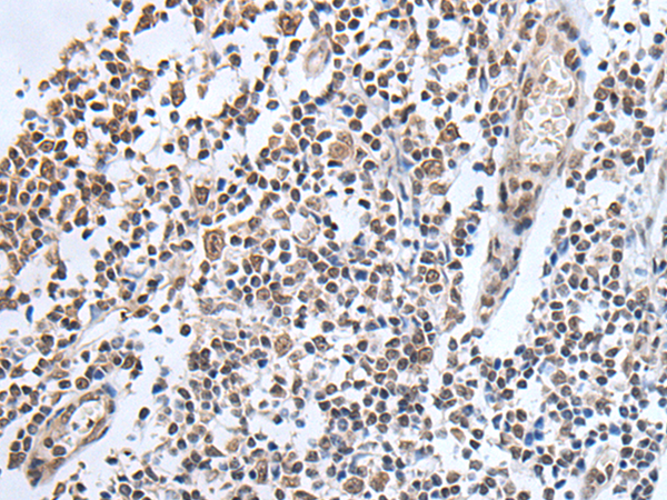 Rabbit Polyclonal Antibody to ADAMTS7