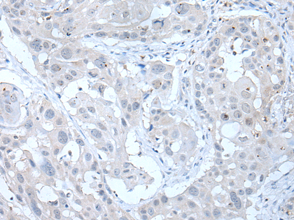 Rabbit Polyclonal Antibody to ANGPTL6
