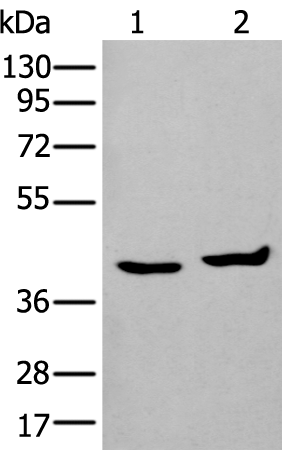 Rabbit Polyclonal Antibody to PICK1