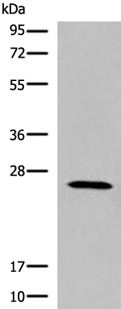 Rabbit Polyclonal Antibody to KLRK1