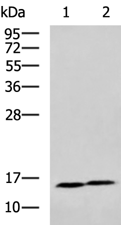 Rabbit Polyclonal Antibody to SST