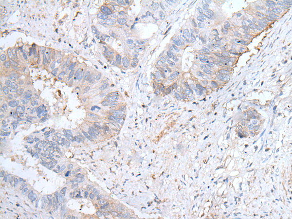 Rabbit Polyclonal Antibody to GPD2