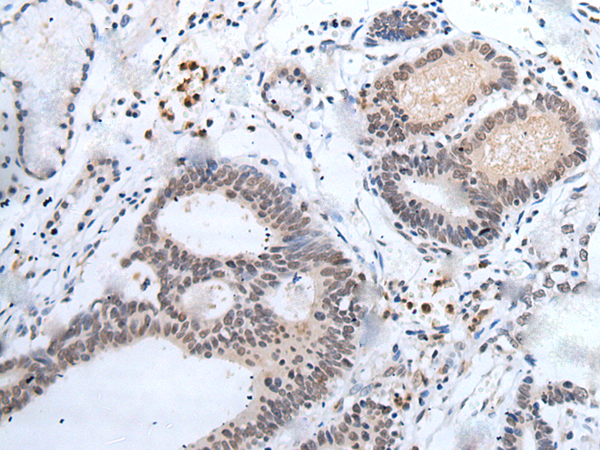 Rabbit Polyclonal Antibody to MAGED1