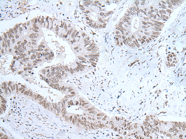Rabbit Polyclonal Antibody to HCRT