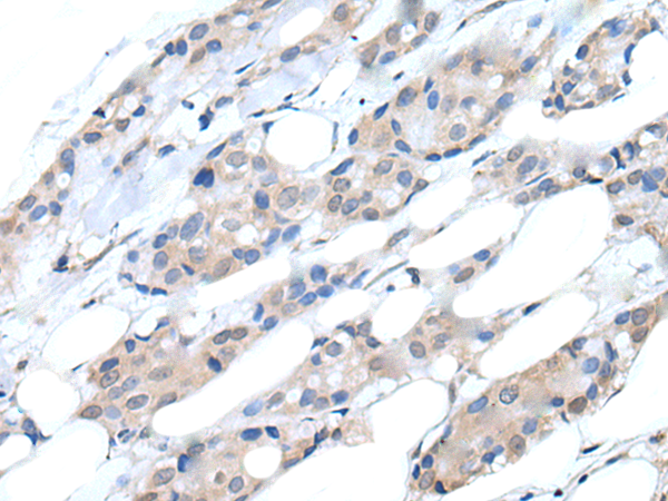 Rabbit Polyclonal Antibody to PIK3CA