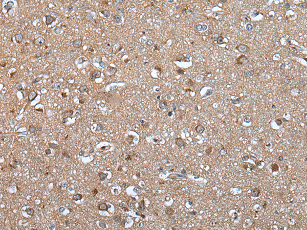 Rabbit Polyclonal Antibody to EPHA5