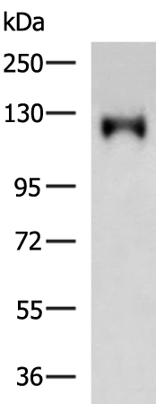 Rabbit Polyclonal Antibody to ADCY2