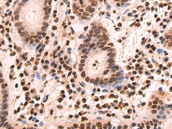 Rabbit Polyclonal Antibody to HAND1