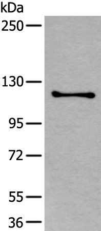 Rabbit Polyclonal Antibody to ULK1