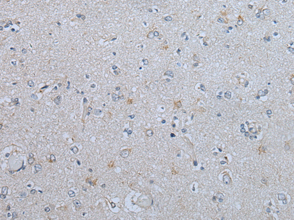 Rabbit Polyclonal Antibody to CENPF