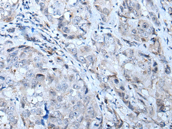 Rabbit Polyclonal Antibody to CTR9