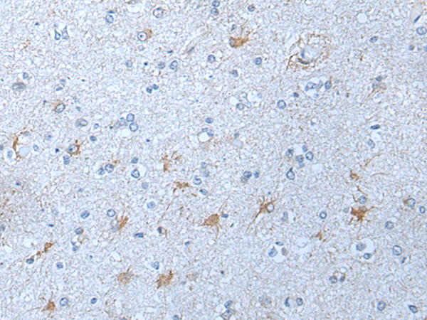 Rabbit Polyclonal Antibody to KLK12
