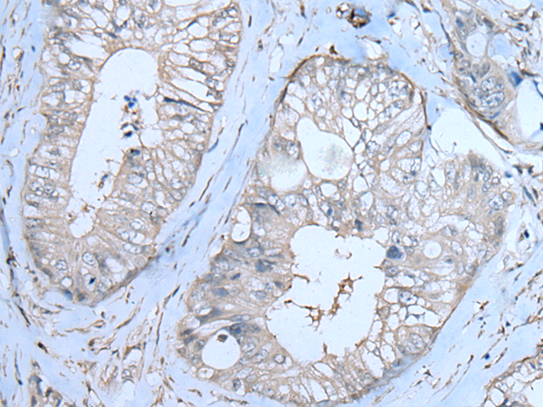 Rabbit Polyclonal Antibody to ZBTB40