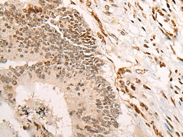 Rabbit Polyclonal Antibody to VGLL3