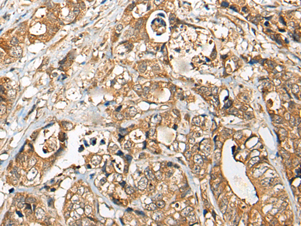 Rabbit Polyclonal Antibody to YEATS2