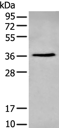 Rabbit Polyclonal Antibody to NHEJ1