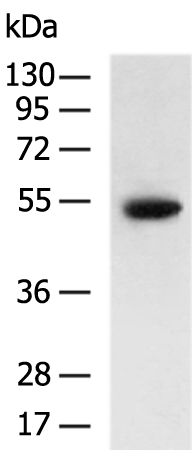 Rabbit Polyclonal Antibody to SUN5