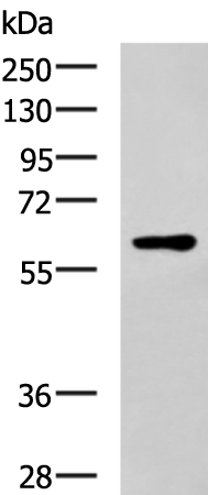 Rabbit Polyclonal Antibody to SLC17A8