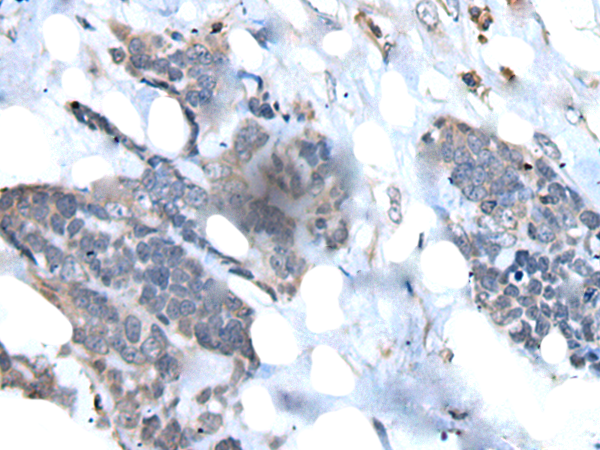 Rabbit Polyclonal Antibody to VPREB1