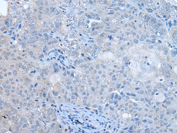 Rabbit Polyclonal Antibody to UBAC2