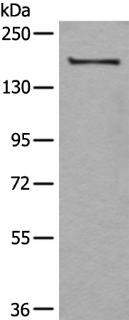 Rabbit Polyclonal Antibody to UGGT1