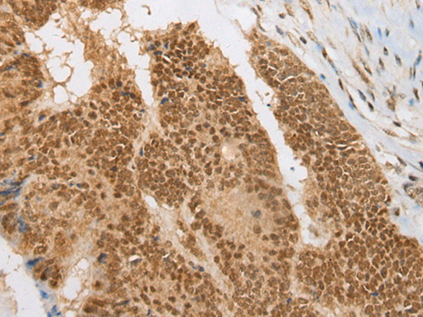 Rabbit Polyclonal Antibody to ATRX