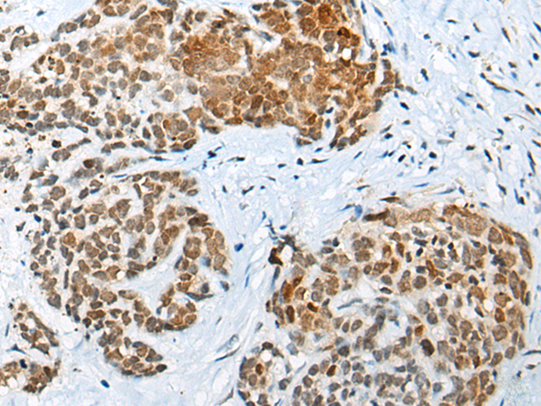 Rabbit Polyclonal Antibody to NKX3-2
