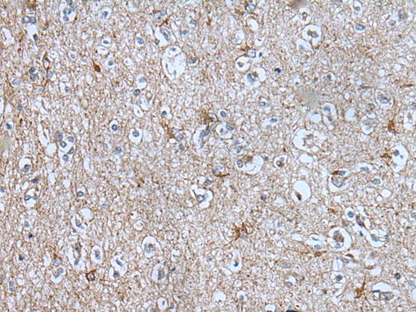 Rabbit Polyclonal Antibody to BMP1