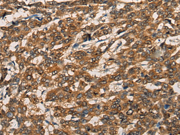 Rabbit Polyclonal Antibody to BMPER