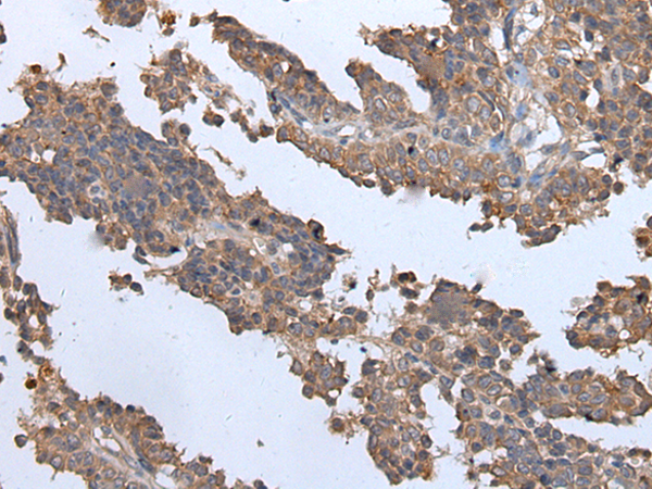 Rabbit Polyclonal Antibody to ENPP2