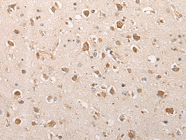 Rabbit Polyclonal Antibody to SFR1