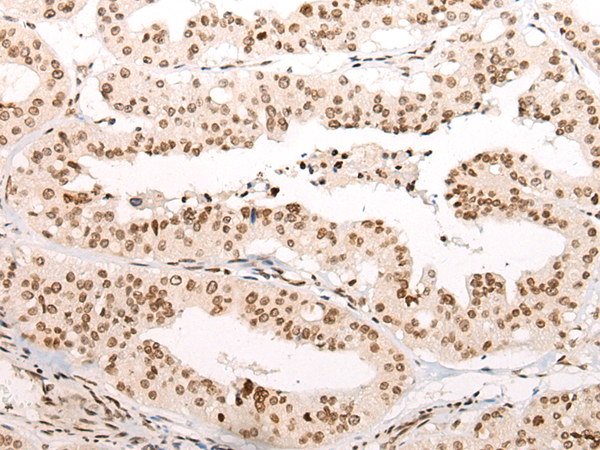 Rabbit Polyclonal Antibody to VPS51