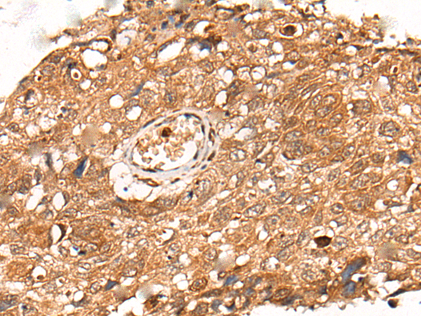 Rabbit Polyclonal Antibody to KLHL36