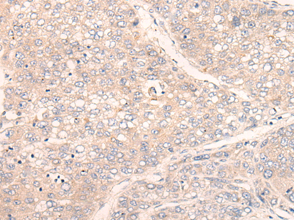 Rabbit Polyclonal Antibody to NTPCR