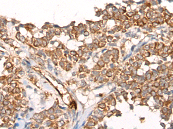 Rabbit Polyclonal Antibody to CA5B