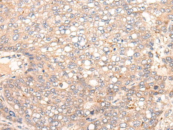 Rabbit Polyclonal Antibody to CACNA1B