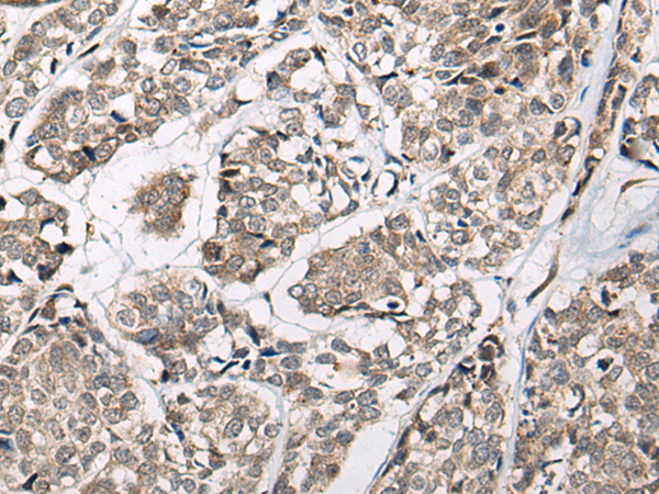 Rabbit Polyclonal Antibody to CACNB3