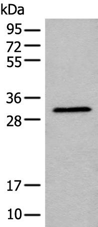 Rabbit Polyclonal Antibody to RCAN3