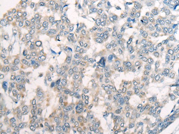 Rabbit Polyclonal Antibody to CCIN