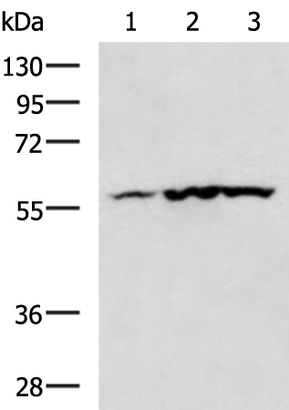 Rabbit Polyclonal Antibody to CAMK2G