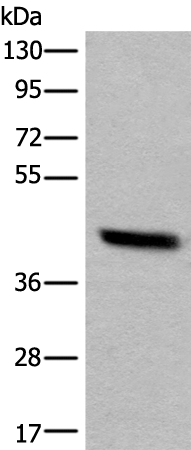 Rabbit Polyclonal Antibody to PRKACA