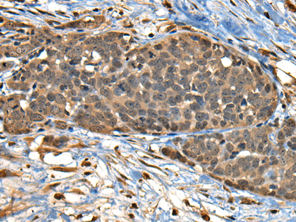 Rabbit Polyclonal Antibody to CBFA2T3