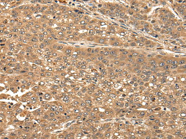 Rabbit Polyclonal Antibody to CBLN3