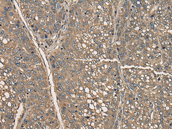 Rabbit Polyclonal Antibody to CD5