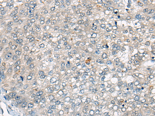 Rabbit Polyclonal Antibody to CDV3