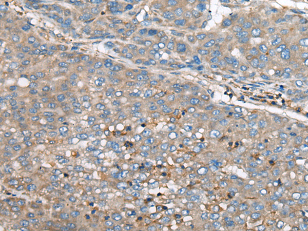 Rabbit Polyclonal Antibody to GULP1